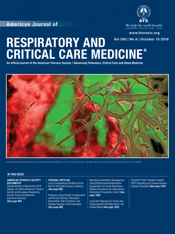 Comparative Modelling of Tuberculosis Epidemiology and Policy Outcomes in California